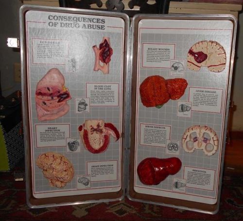 Vintage Consequences of Drug Abuse Medical Display Health Edco Brain on Drugs