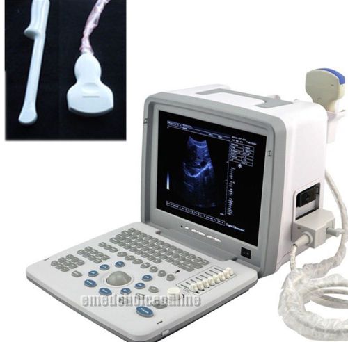 2015 w digital laptop ultrasound scanner+convex+ transvaginal probe+ external 3d for sale