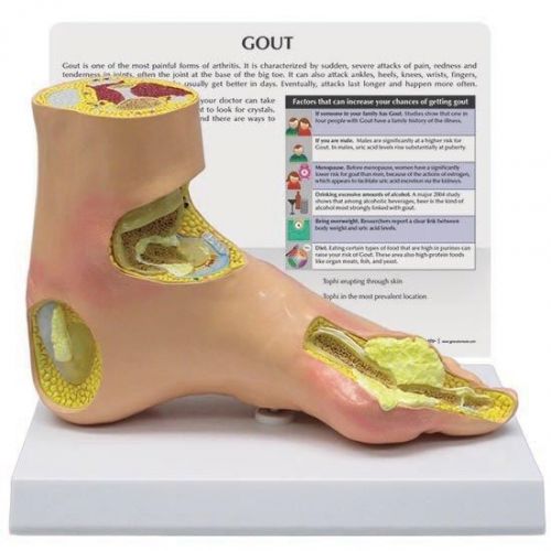 NEW GPI Anatomical Gout Foot Model OVERSTOCKED RETURNED by customer