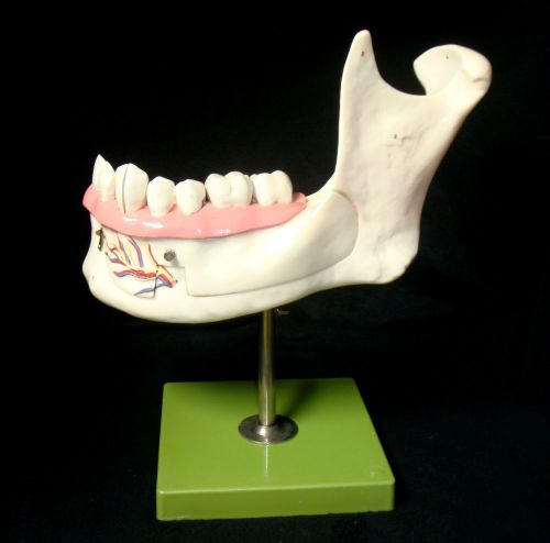 Somso es4 lower jaw of an 18-year-old dental anatomical model (es 4) for sale