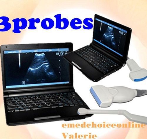FREE 3D Full Digital Laptop Ultrasound Scanner+Covex+Linear+TV 3Probes ONE MONTH