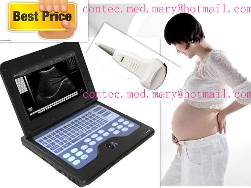 Portable Hot  Ultrasound Diagnostic Scanner machine+3.5MHz Convex Probe On Sale!
