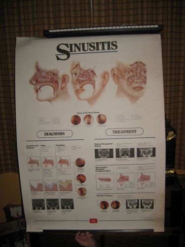Vintage  Nose Sinusitis Medical / Doctors wall chart