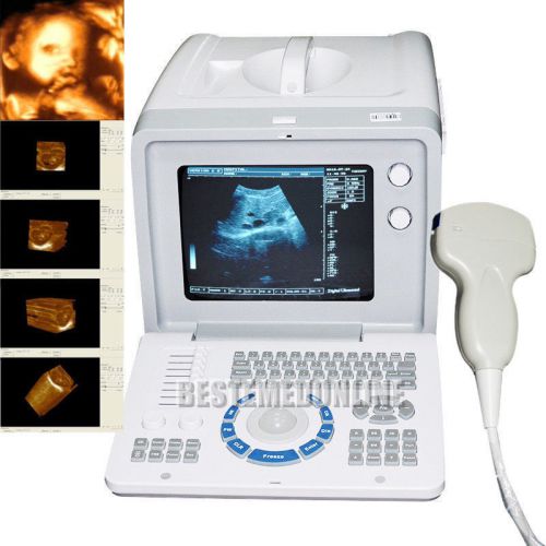 Ce fda ultrasound scanner machine +convex probe +free 3d software + 2ys warranty for sale