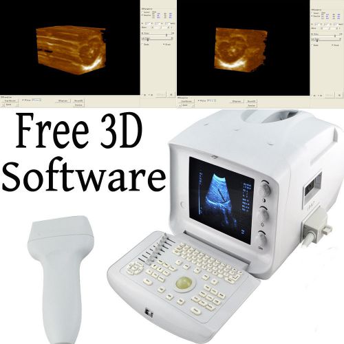 3D Portable Digital Ultrasound Machine/Scanner Linear Probe with 3D Workstation