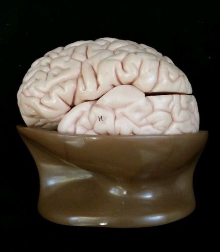 Somso BS20-1 Half Of The Human Brain Anatomical Model, 4 part, labeled (BS 20-1)
