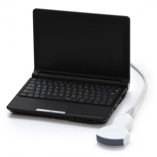 CE Full Digital Laptop Ultrasound Scanner with Convex Probe+ External 3D 2015FDa