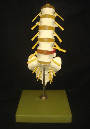 SOMSO QS 64 Lumbar Vertebral Column Anatomical Model