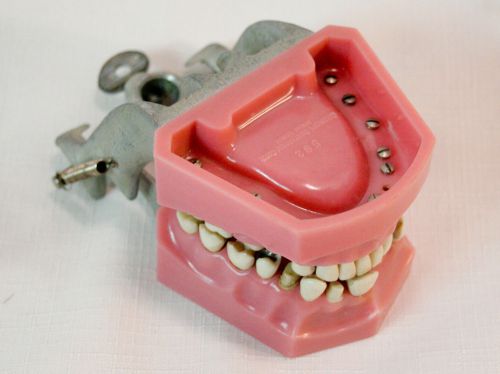 Columbia Dentoform Corp 562 Dental Model Teeth &amp; Fillings