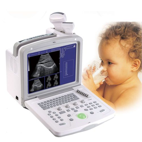 Ce, portable ultrasound scanner,diagnostic system cms600b-3+3.5m convex probe for sale