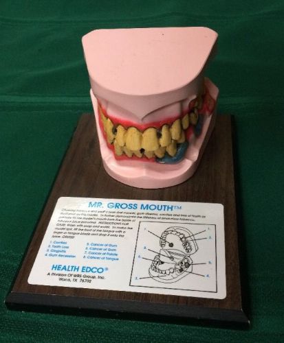Mr gross mouth dental model rubber tongue teaching points of tobacco dangers for sale