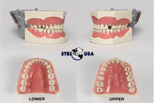 Dental typodont model 860 prep teeth model fits columbia brand removable  teeth for sale