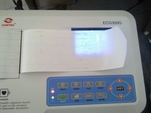 Ce approved 3 channels ecg ekg machine,electrocardiograph /w softawre &amp; printer for sale