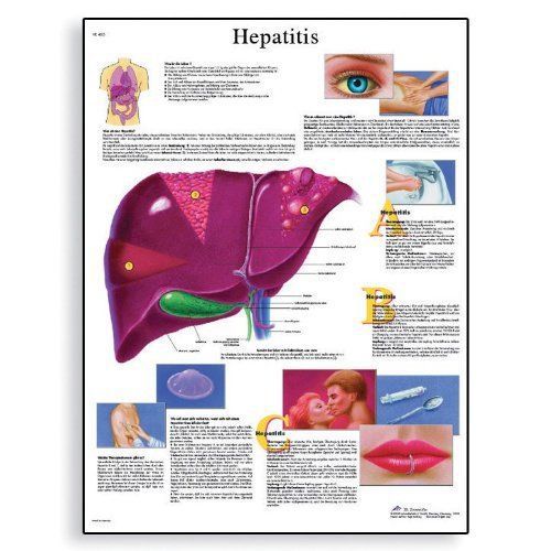 3b scientific vr1435l glossy laminated paper hepatits anatomical chart  poster s for sale