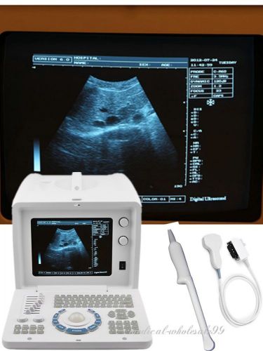 2015 digital portable ultrasound scanner/machine convex+transvaginal 2 probe usb for sale