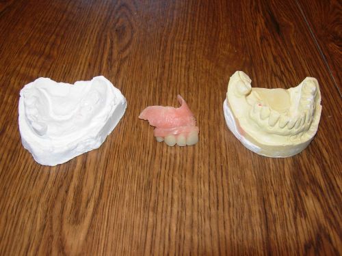 2 plaster dental moulds &amp; 1 dental partial/dental bridge