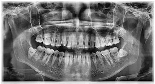 2013 Vatech Pax I3D +CBCT Digital Dental x Ray 1 yr Wrnty Free Install