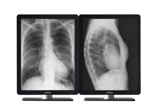 New pair (x2) barco coronis mdcg-3221 led 3mp grayscale medical monitors for sale