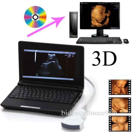 10.1 Inch Full Digital Laptop Notebook Ultrasound Scanner 3.5Mhz Convex Probe 3D