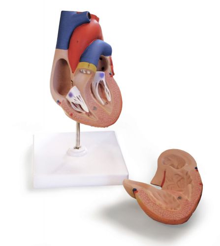 Vision Scientific VAC405-AN Life Size Heart Model (2 PARTS)