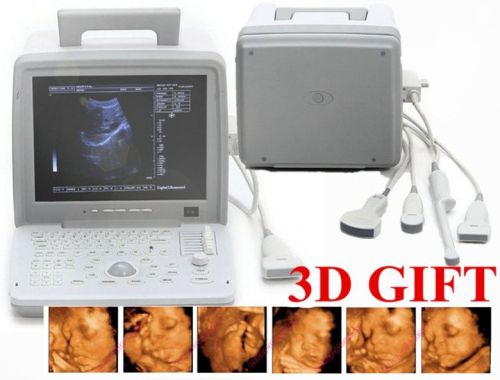 Factory!! 12.1inch digital laptop ultrasound scanner+convex+ transvaginal probe for sale