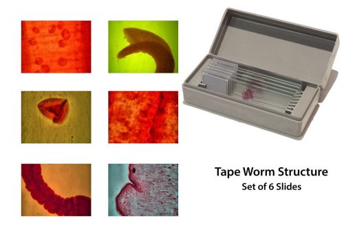 Microscopy Prepared Slides: Tape Worm Structure - Set of 6