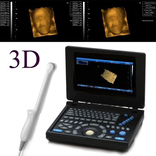 High-resolution full digital laptop ultrasound scanner pc trans-vaginal probe 3d for sale