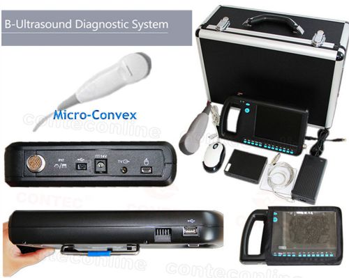 Palmsmart B-Ultrasound Scanner Diagnostic System+5.0M Micro-convex Probe CMS600S