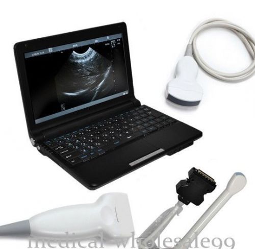 10.1&#034; Laptop Ultrasound Scanner/Machine+Convex &amp; Linear&amp;Transvaginal 3 probes