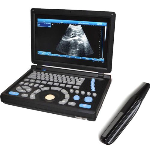 10.4&#039;&#039; Veterinary Digital Laptop PC Ultrasound Scanner with Rectal Probe 3D