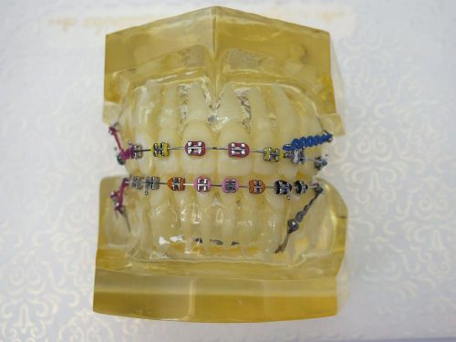 Orthodontic Teeth Brackets Model Ceramic
