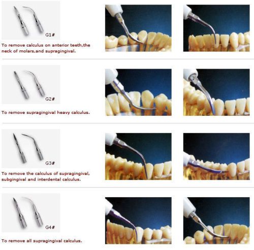 Dental Ultrasonic Scaler Scaling Tip G1 G2 G3 G4 Fit EMS &amp; WOODPECKER