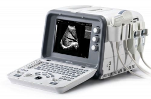 Edan dus6 digital ultrasonic diagnostic imaging system - brand new for sale