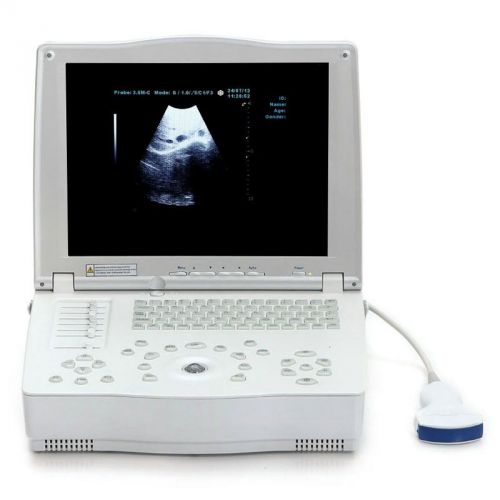 3D Image Digital Laptop Ultrasound Scanner 128-frame VGA port Convex Probe 15&#034;