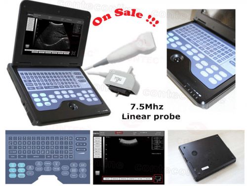 Hot!B-Ultrasound Diagnostic System Ultrasound scanner + 7.5Mhz linear probe