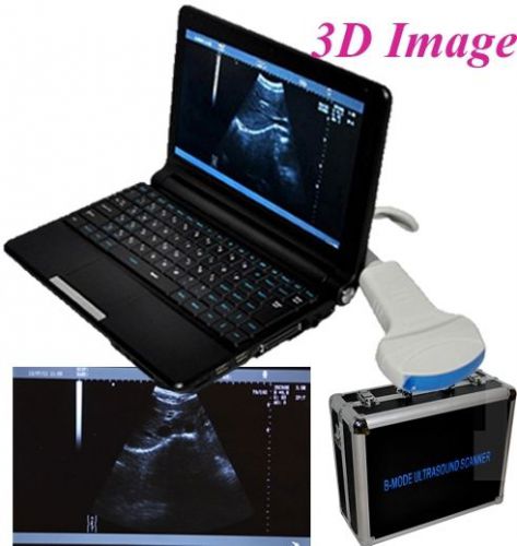 CE Approved Digital PC Laptop Ultrasound Scanner with Box+Free 3D+Convex Probe