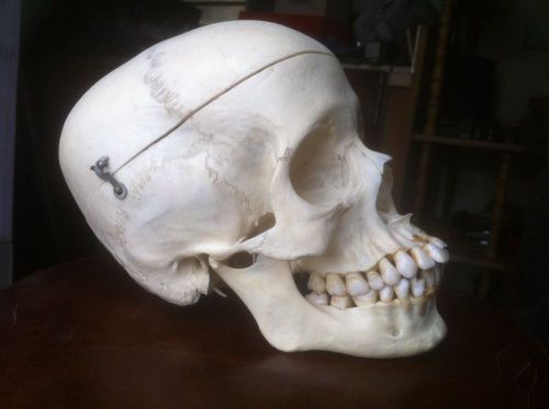 Real Human Skull Articulated for Medical / Educational Use.. Excellent Cond.