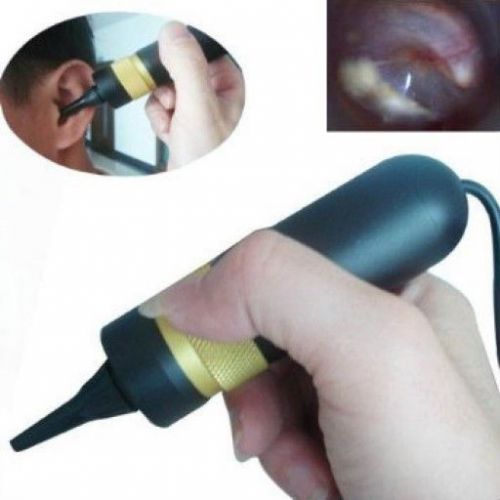 Optramed Video Otoscope for educational and industrial inspection