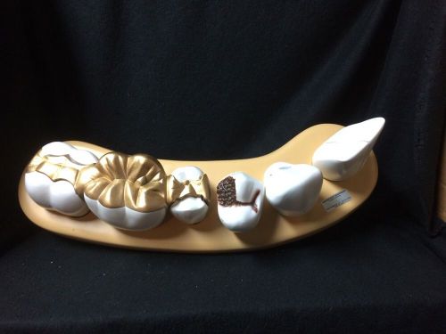 Denoyer geppert a84 dental morphology anatomical teeth model 7-part series -a 84 for sale