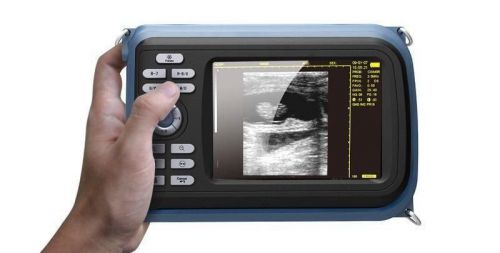 A+ NEW Digital Portable PalmSmart Ultrasound Scanner &amp; Convex Probe B ultrasonic