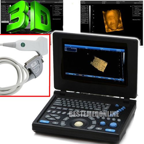 2015 new ce fda 3d full digital laptop ultrasound scanner 7.5mhz linear probe for sale