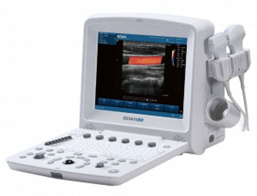 Edan u50 diagnostic ultrasound system - brand new for sale
