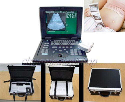 2014 New Laptop Diagnostic Ultrasound Scanner/System with Convex/Abdominal Probe