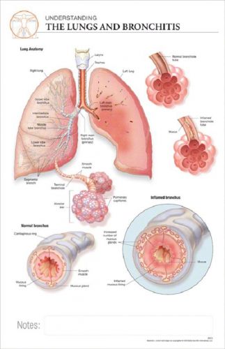 11 x 17 post-it disease chart:lungs &amp; bronchitis for sale
