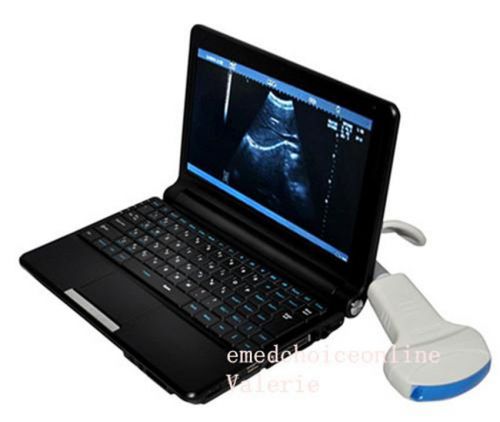 Laptop Note Full_Digital Ultrasound Scanner with Micro-convex Cardiac probe + 3D