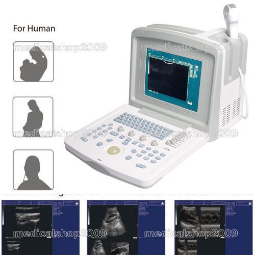 High Resolution Portable Ultrasound Scanner + Convex Probe,3Y warranty,CE