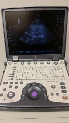 GE Logiq E Portable Ultrasound Machine With 3s-rs Cardiac and Vascular Probe