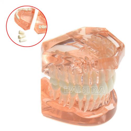 Dental Jaw Adult Typodont Model All Teeth Removable Transparent Upper And Lower