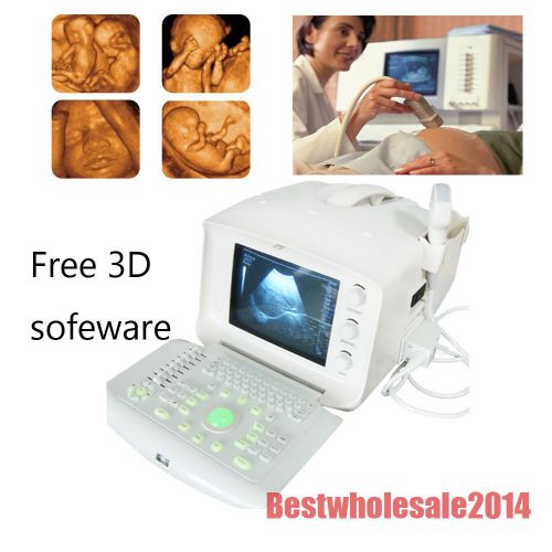 Ca free 3d portable digital ultrasound machine/scanner convex + linear 2 probe for sale