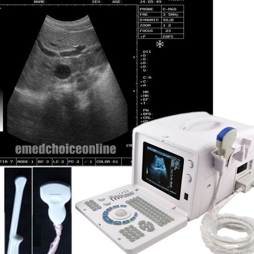Digital ultrasound scanner+convex transvaginal 2 probe/option linear probe+3d ce for sale